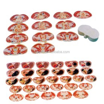 Anatomical Demonstration Male Torso Transverse Section Model Human Anatomical Models