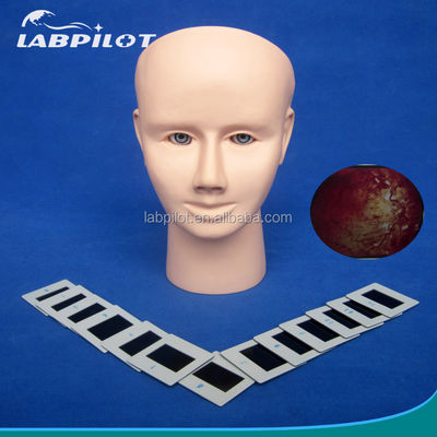 Manikin for Advanced Human Eye Examination Training Simulator Retinopathy Fundus Model