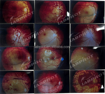 Manikin for Advanced Human Eye Examination Training Simulator Retinopathy Fundus Model