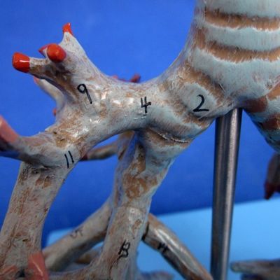Vivid Anatomical Bronchial Tree Model 26 Positions Marked Trachea Anatomy for Medical Science