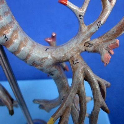 Vivid Anatomical Bronchial Tree Model 26 Positions Marked Trachea Anatomy for Medical Science