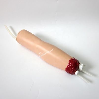 Trauma Nursing Care Model Arm Amputation and Hemostasis for Upper Limb Wound Treatment