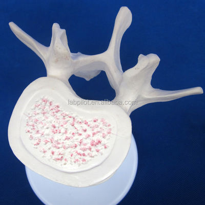 Vivid Vertebra Models for Medical Science Atlas Axis Cervical Thoracic and Lumbar