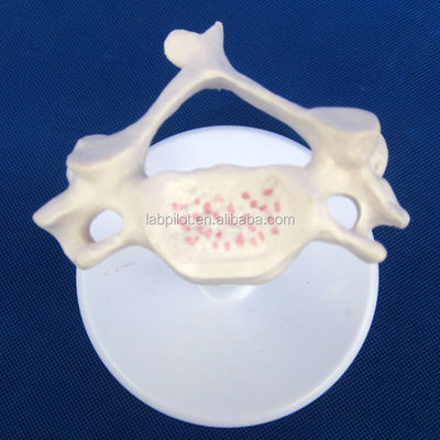 Vivid Vertebra Models for Medical Science Atlas Axis Cervical Thoracic and Lumbar