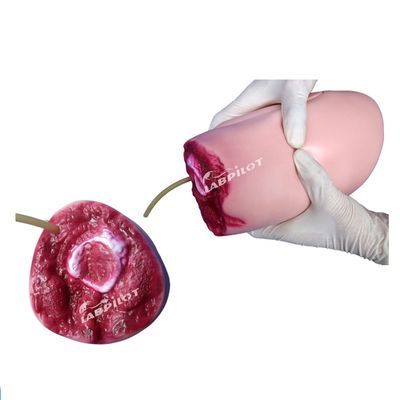 Advanced PVC Model The Ideal Solution for Lower Limb Trauma Thigh Amputation Nursing