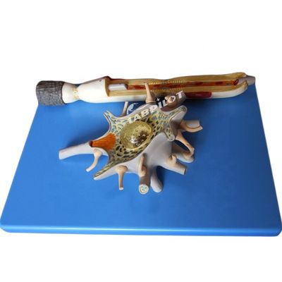 Advanced PVC Anatomical Model of Enlarged Neuronal Cell Body and Nerve Fiber Structure