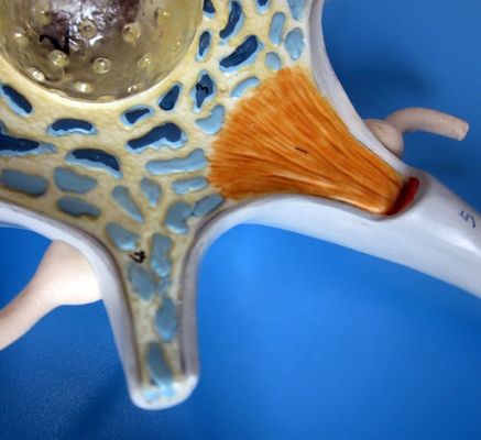 Advanced PVC Anatomical Model of Enlarged Neuronal Cell Body and Nerve Fiber Structure