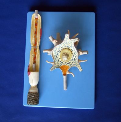 Advanced PVC Anatomical Model of Enlarged Neuronal Cell Body and Nerve Fiber Structure