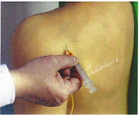 Advanced PVC Medical Training Shoulder Joint Intracavitary Injection Simulator Teaching Model
