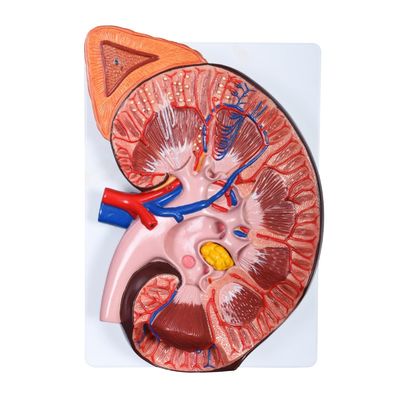 Detachable Anatomical Kidney Model for Medical Demonstrations in Hospitals and Clinics