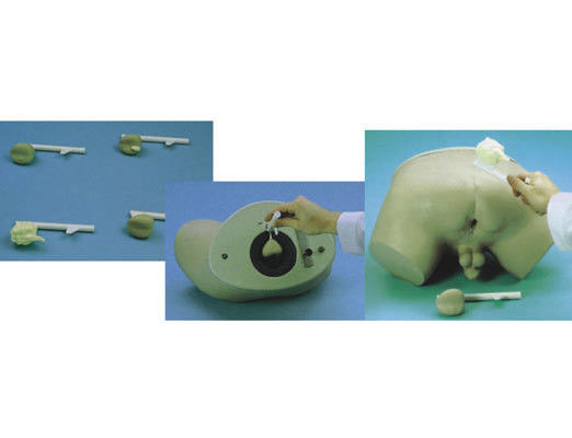 Prostate Diseases Model Patients Care Demonstration with Vivid Human Teaching Model