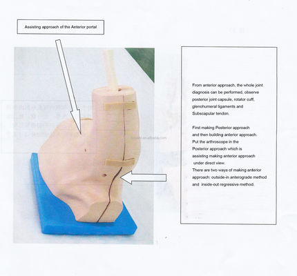 Vivid Shoulder Joint Anatomy Training Model with Detachable Shoulder Arthroscopy Simulator