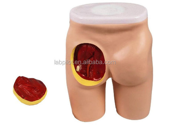 Comprehensive IM Injection Teaching Model for Gluteal Muscles and Anatomy Education