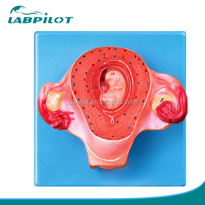 Advanced PVC Uterus Model for Second Month Pregnancy Anatomical Uterus Demonstration