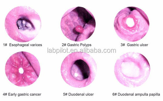 Advanced Gastroscopic Examination and ERCP Training Model for Gastrointestinal Lesions