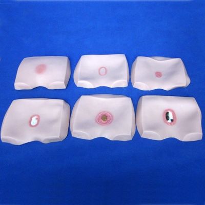 Clinical Nursing Training Models Stages of Decubitus Ulcer Nursing Care for Hospitals