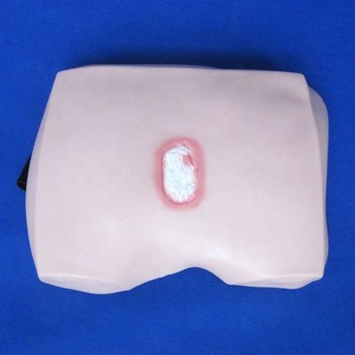 Clinical Nursing Training Models Stages of Decubitus Ulcer Nursing Care for Hospitals