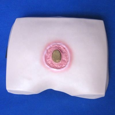 Clinical Nursing Training Models Stages of Decubitus Ulcer Nursing Care for Hospitals