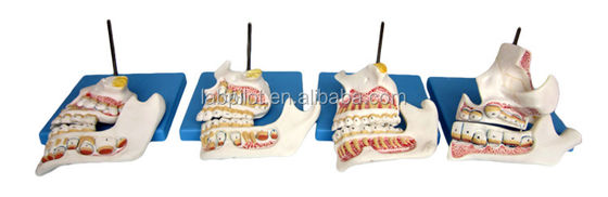 Function Demonstrate Lower Molar Teeth Detailed Anatomy Structures for Dental Research