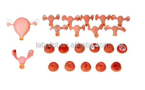 Manikin for Multi-functional Gynecologist Nursing Training Vaginal Examination Model