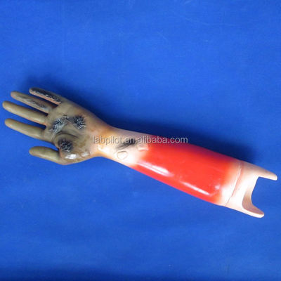 Advanced PVC Trauma Models for Wound Nursing Training and Patients Care Demonstration