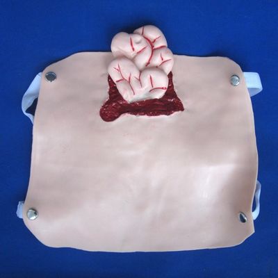 Advanced PVC Trauma Models for Wound Nursing Training and Patients Care Demonstration