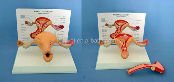 Advanced PVC Human Uterus and Ovary Model for Women's Reproductive System Education