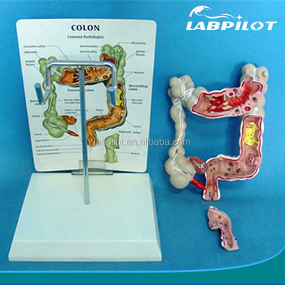 Ophthalmological Anatomical Models Human Intestine Model for Colon and Rectum Diseases
