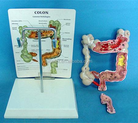 Ophthalmological Anatomical Models Human Intestine Model for Colon and Rectum Diseases