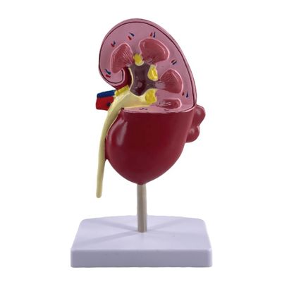 PVC Pathological Kidney Model for Medical Schools and Urology Hospitals Demonstration