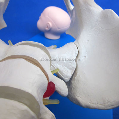 Vivid Pelvis and Fetal Heads Advanced PVC Model for Childbirth Skills Demonstration
