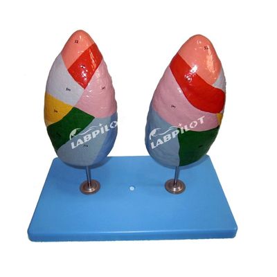 Bronchopulmonary Segments of Lung Model Human Life Size for Schools and Medical Teaching