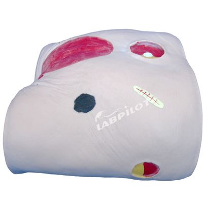 Human Model Decubitus Ulcer Care Training Simulator for Categories in Medical Science