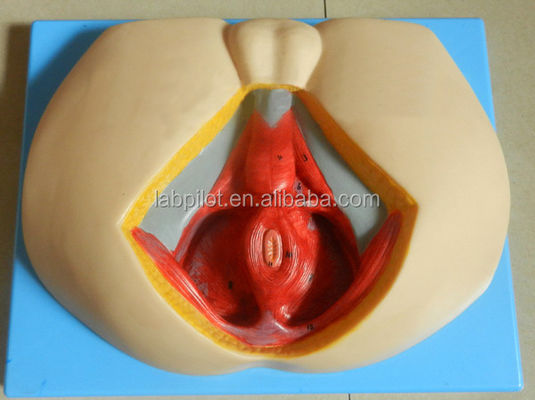 Human Life Size Advanced PVC Perineum Model for Understanding Male Perineal Anatomy