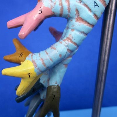 Medical Science Display Detachable Bronchial Tree and Trachea Model for Larynx Anatomy