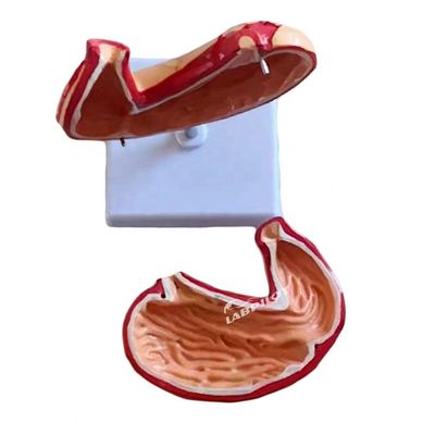 Advanced PVC Medical Teaching Model for Hospitals Human Stomach Anatomical Model