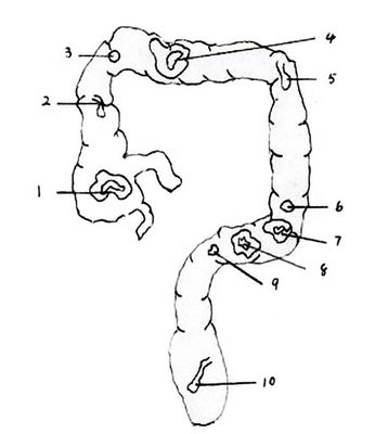 Rectum and Colon Anatomy Model Advanced PVC Human Life Size Intestinal Endoscopy Simulator
