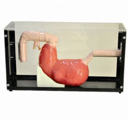 Advanced Gastroscopic Examination and ERCP Training Model for Gastrointestinal Lesions