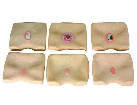 Buttock Skin Decubitus Ulcers Simulator for Hospitals Improve Bedsore Nursing Training