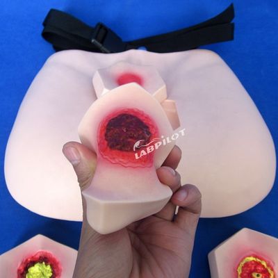 Patients Care Demonstration Pressure Sores Nursing Model Stage Bedsore Teaching Model