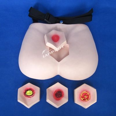 Patients Care Demonstration Pressure Sores Nursing Model Stage Bedsore Teaching Model