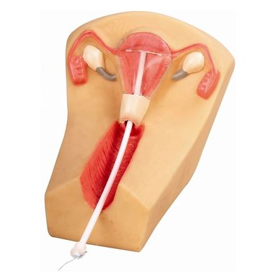 PVC IUD Contraception Simulator The Ideal Teaching Tool for Family Planning