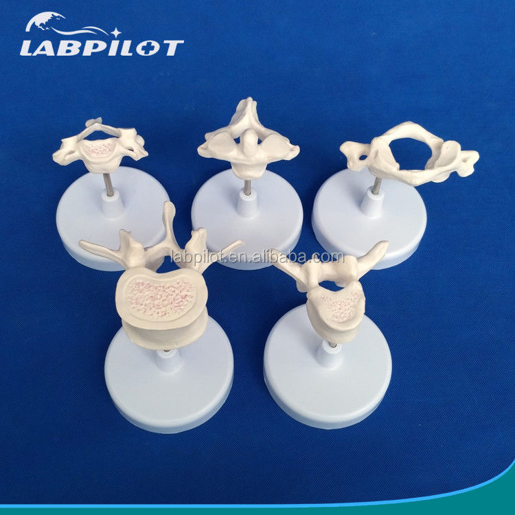 Vivid Vertebra Models for Medical Science Atlas Axis Cervical Thoracic and Lumbar