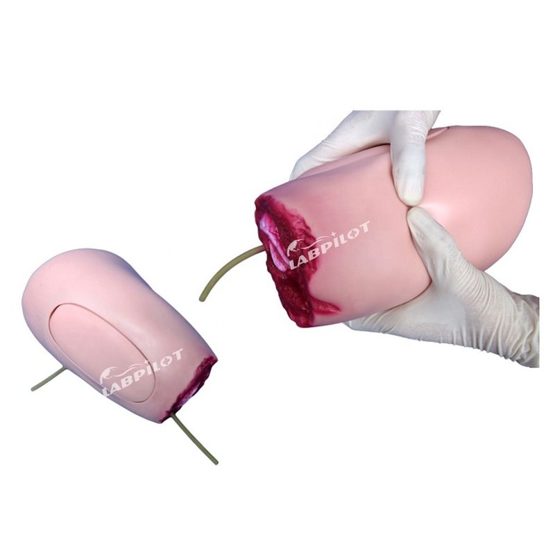 Advanced PVC Model The Ideal Solution for Lower Limb Trauma Thigh Amputation Nursing