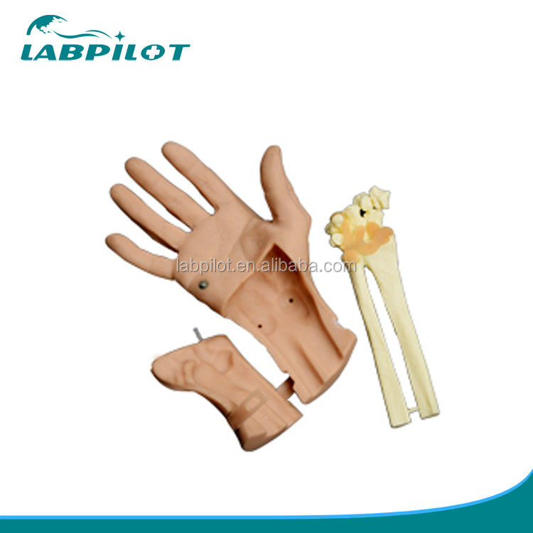 Advantageous Advanced Wrist Arthroscopy Model for Vivid Anatomical Structure of Wrist