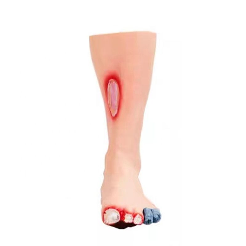 Human Life Size Foot Model The Essential Tool for Diabetic Foot Care Professionals