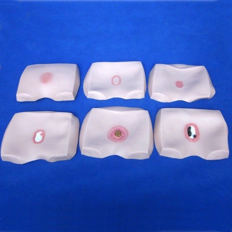 Clinical Nursing Training Models Stages of Decubitus Ulcer Nursing Care for Hospitals
