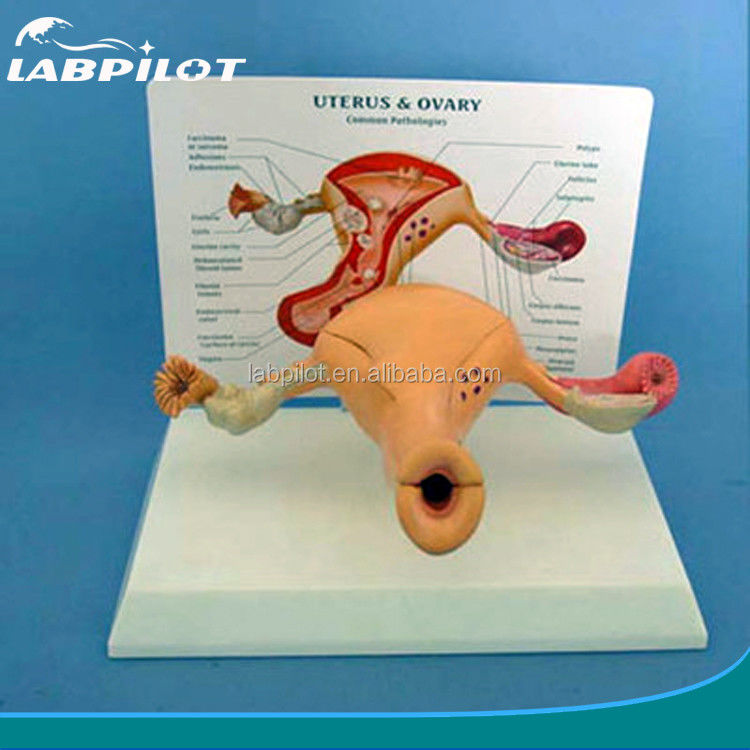 Advanced PVC Human Uterus and Ovary Model for Women's Reproductive System Education