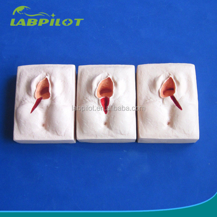 Advanced PVC Episiorrhaphy Training Simulator for Realistic Vulva Suturing Techniques