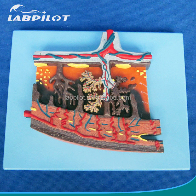 Vivid Placenta Model 3D Placenta Tissue and Umbilical Cord for Anatomy Demonstrations